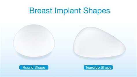 Breast augmentation